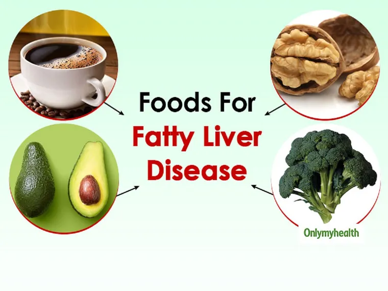 Diet for Fatty Liver Disease: How Smart Eating Habits Can Transform Liver Health and Prevent Serious Complications