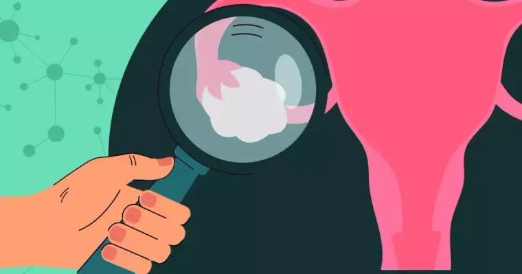 CAH in Women: Understanding the Symptoms, Causes, and Lifelong Management of Congenital Adrenal Hyperplasia