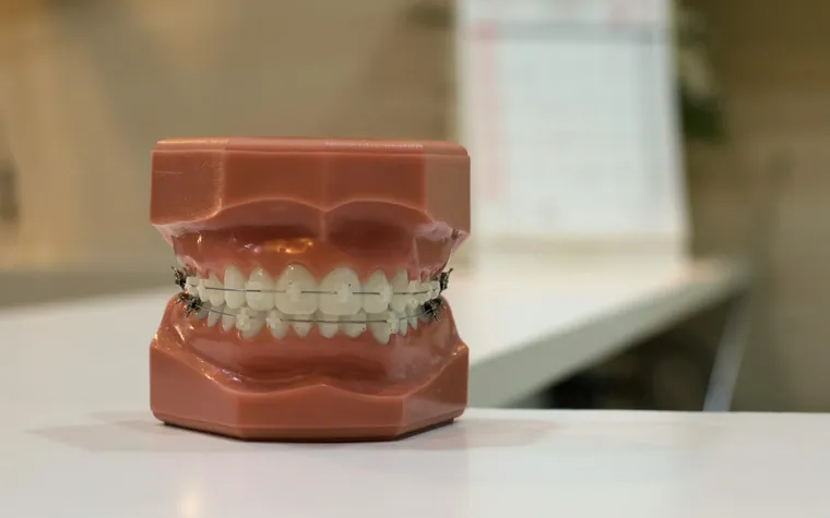 Affordable Smiles: How Seniors Can Get Dentures Covered by Medicare Plans
